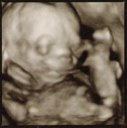 3 boyutlu ultrason görüntüsü