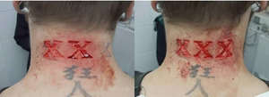 scarification tattoo