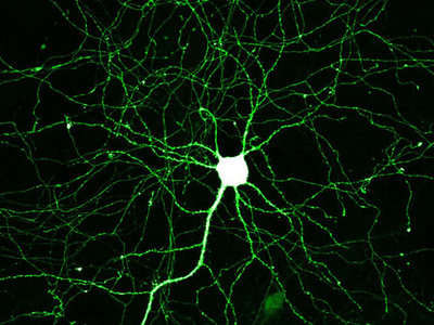elektron mikroskobunda bir nöronun görünüşü