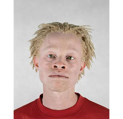 afrikalı albino